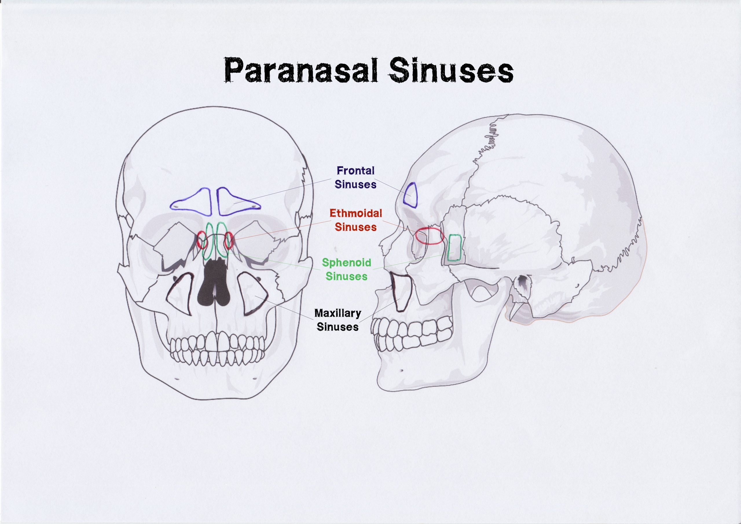 Paranasal Sinuses Brain Fog