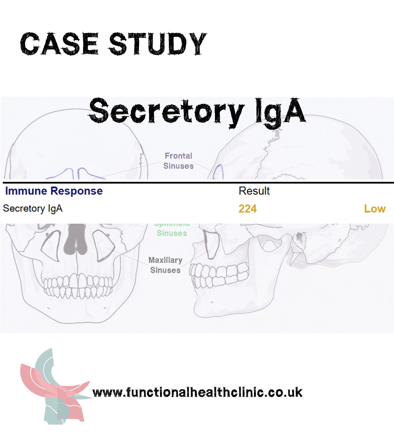 Low Secretory IgA
