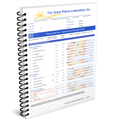Organic Acids Lab Test, Functional Lab Testing