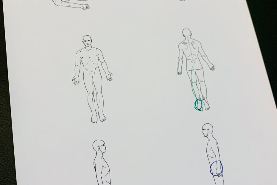 Disrupted Gait Pattern