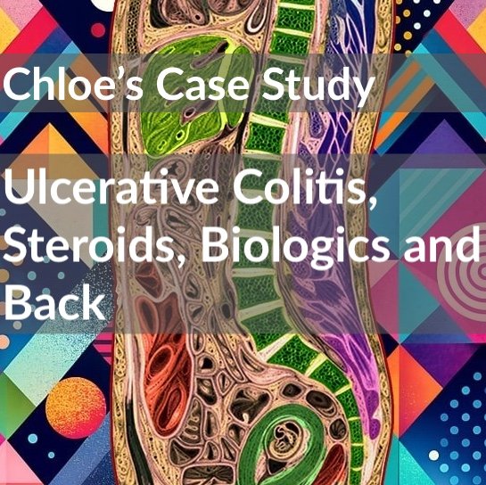 Ulcerative colitis Steroids and Biologics
